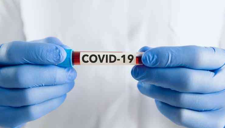 covid provetta