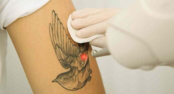 ¿Qué pasa cuando quieres eliminar tatuajes de tu cuerpo? el cuento de este hombre dejó sin palabras