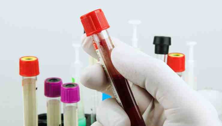 provette sangue