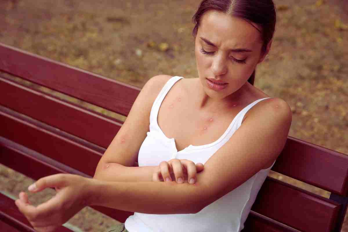 mujer con picadura de insectos